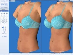 VECTRA demonstration of before and after a breast lift