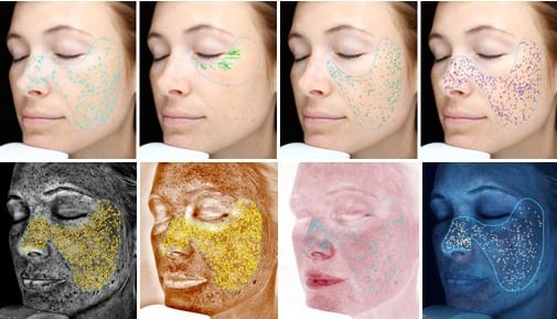 VISIA skin analysis demonstrations