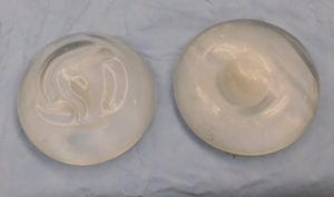 Two new breast implants before being placed in the body