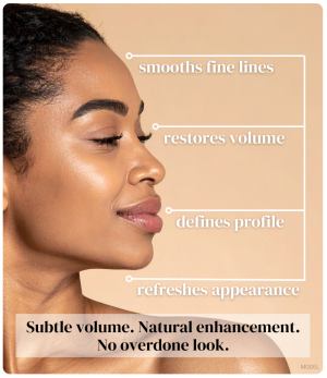 fillers benefits. (model)